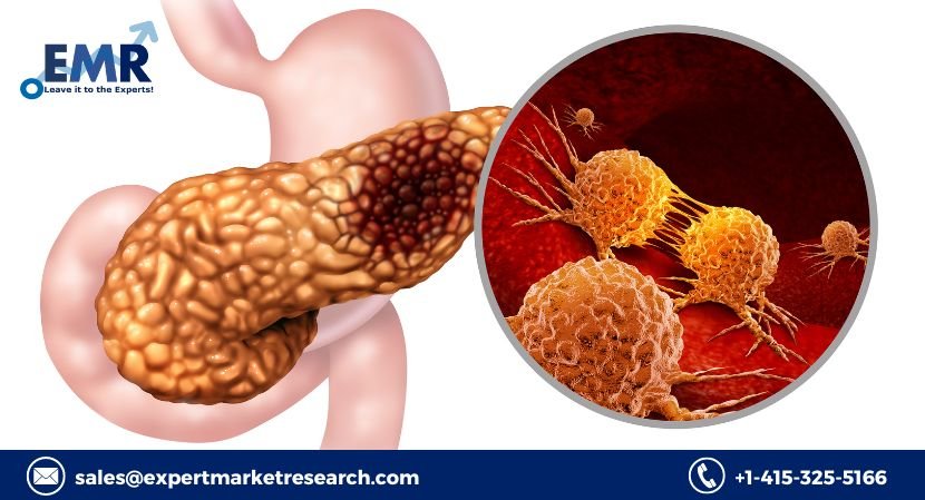 Global Exocrine Pancreatic Insufficiency Treatment Market Share, Price, Trends, Growth, Analysis, Key Players, Outlook, Report, Forecast 2023-2028