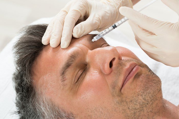 Dermal Fillers for Men