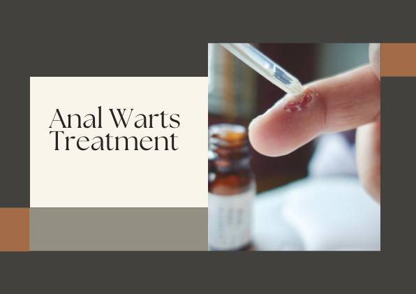 Importance Timely Anal Warts Treatment