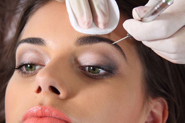 Brow Lift Process