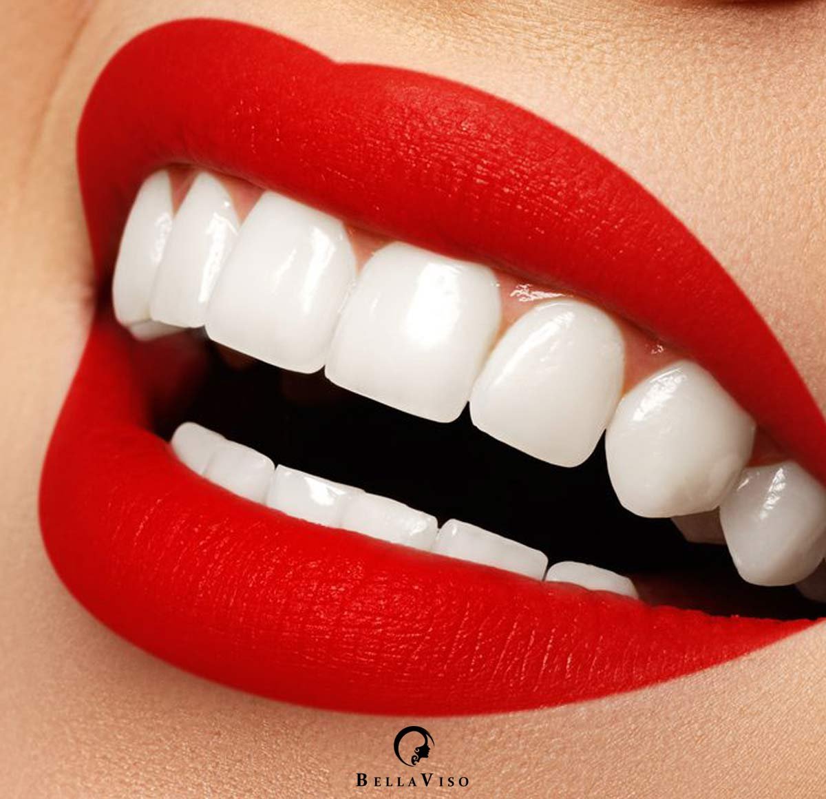 Enhance Your Smile with Dental Veneers in Dubai