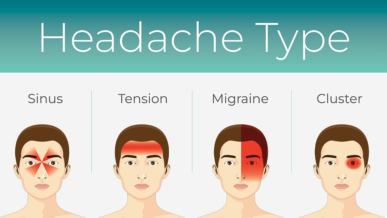 Easy Treatment for Headaches Minneapolis