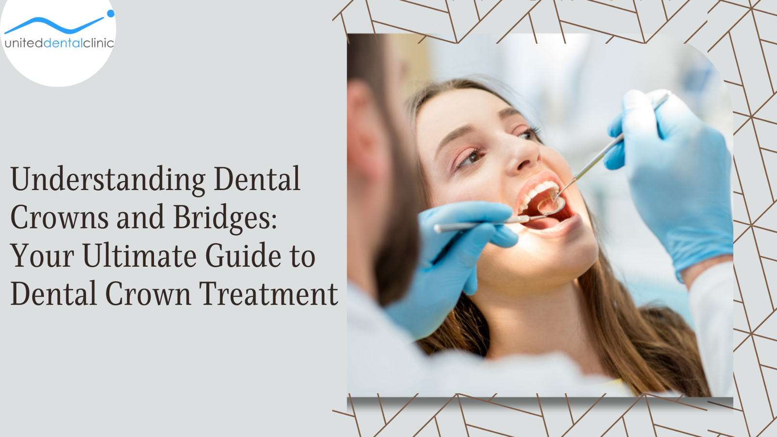 Understanding Dental Crowns and Bridges: Your Ultimate Guide to Dental Crown Treatment